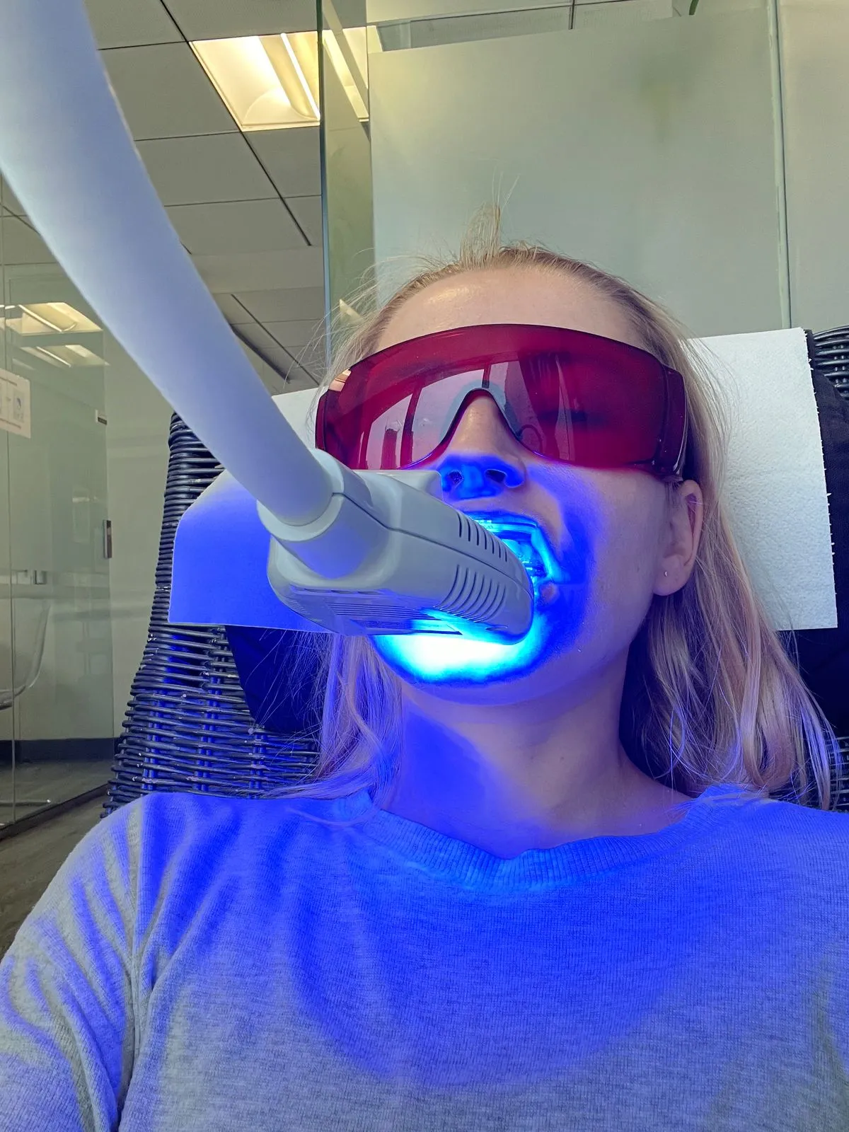 Zoom! Teeth Whitening at HB Dentist Huntington Beach